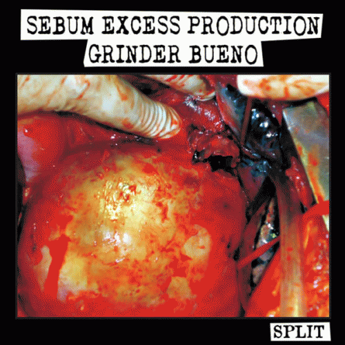 Sebum Excess Production : Sebum Excess Production - Grinder Bueno